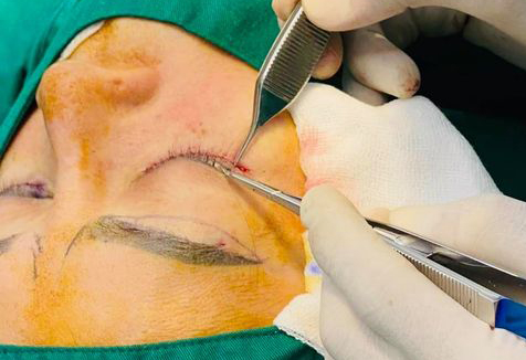 Quality control optical inspection of surgical instruments